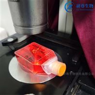 SU-DHL-2人B細(xì)胞淋巴瘤細(xì)胞