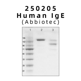 Human IgE（免疫球蛋白E）