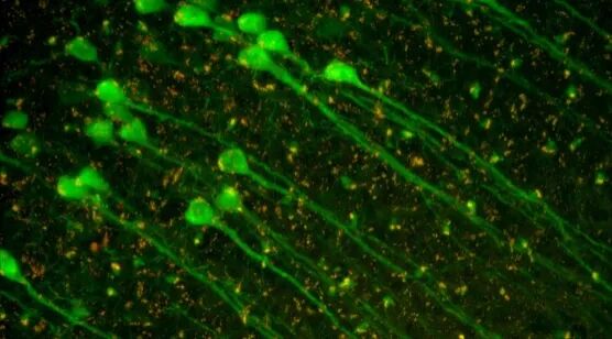显微课堂 | 罕见疾病 CRISPR 疗法的开发与风险解除