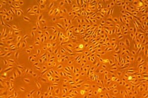 LONZA原代人冠狀動脈內(nèi)皮細(xì)胞HCAEC和培養(yǎng)基 產(chǎn)品介紹