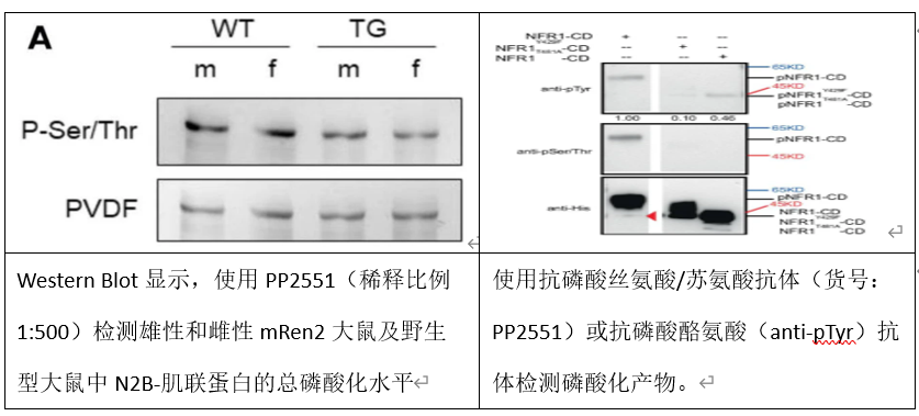告別位點(diǎn)選擇焦慮！高效廣譜的磷酸化絲氨酸/蘇氨酸抗體新選擇